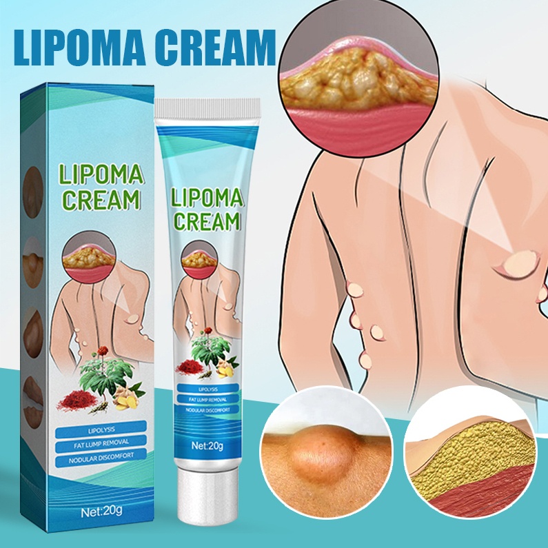 Lipoma Removal Cream Original (1 pcs)